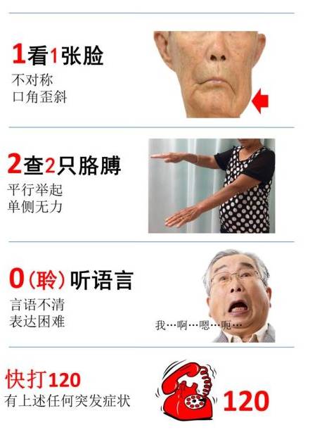 一张图测痴呆、脑梗、视力,50岁后每年都要测!太实用了 一张图测痴呆、脑梗、视力,50岁后每年都要测!太实用了